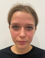 Barbara  STACHÓW