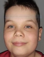 Patryk ŁYŚ