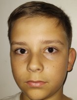 Alan KRASUCKI