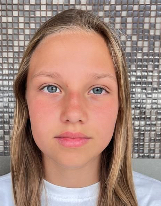 Apolonia FĄS